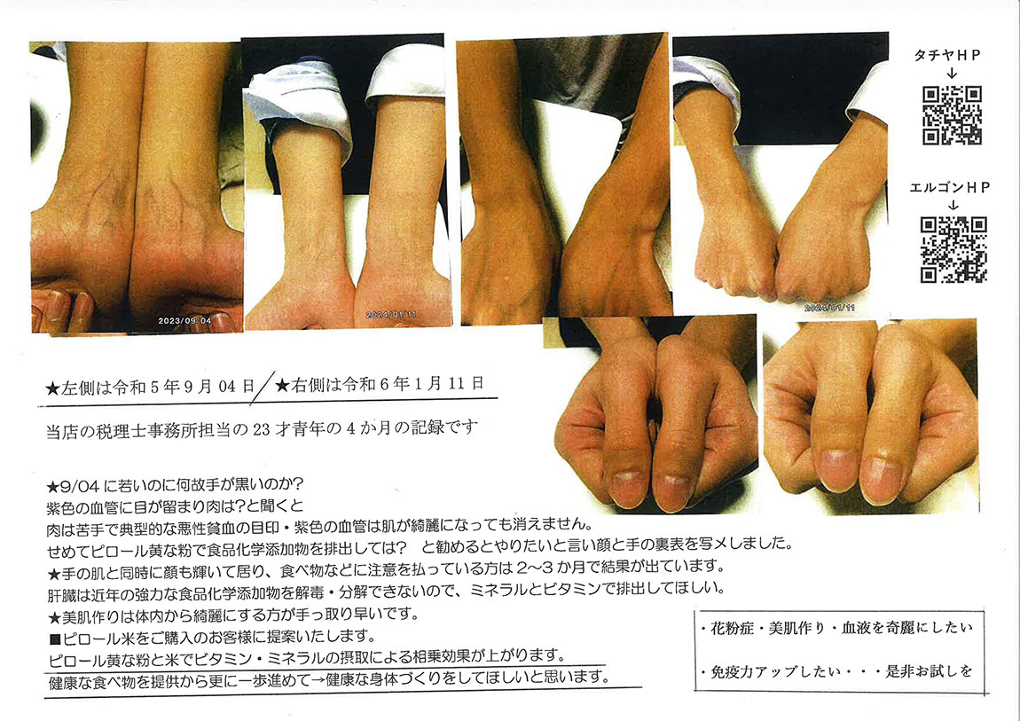 なぜ手が黒いのか